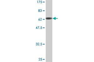Western Blot detection against Immunogen (67. (MEIS2 anticorps  (AA 1-381))