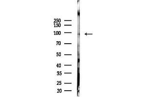 Western blot analysis of lysates from COLO205 cells(starvation 24h treatment), using NUP98 Antibody at 1/1000 dilution.