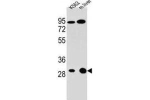 Western Blotting (WB) image for anti-Electron-Transfer-Flavoprotein, alpha Polypeptide (ETFA) antibody (ABIN2996035) (ETFA anticorps)