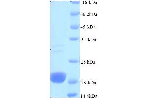 SDS-PAGE (SDS) image for gH (AA 24-195) protein (His tag) (ABIN5714022) (gH (AA 24-195) protein (His tag))