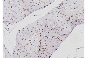 ABIN6269016 at 1/100 staining Human gastric tissue by IHC-P. (Ku70/80 anticorps)