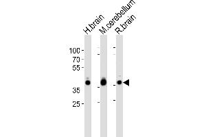 Western blot analysis of lysates from human brain, mouse cerebellum and rat brain tissue lysate (from left to right), using ALDOC Antibody (C-term) (ABIN389207 and ABIN2839365). (ALDOC anticorps  (C-Term))