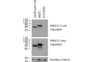 Western blotting analysis of human PPM1D using mouse monoclonal antibody 7E11/C5 on lysates of U2OS parental cells, expressing both natural (70 kDa, low expression) and C-terminally truncated version (55 kDa, high expression) of PPM1D, and on lysates of MCF7 cells (high PPM1D expression) and RPE cells (low PPM1D expression), reducing conditions. (PPM1D anticorps)