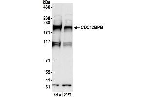 anti-CDC42 Binding Protein Kinase beta (DMPK-Like) (CDC42BPB) (AA 750-800) antibody