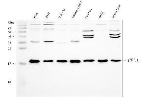 Western blot analysis of Cofilin using anti-Cofilin antibody (ABIN3042746). (Cofilin anticorps  (C-Term))