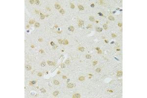 Immunohistochemistry of paraffin-embedded mouse brain using SLC37 antibody (ABIN7270453) at dilution of 1:100 (40x lens).