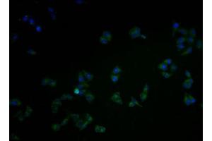 Immunofluorescence staining of Hela cells with ABIN7146440 at 1:100, counter-stained with DAPI. (CAMK2A anticorps  (AA 321-478))