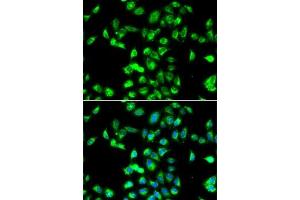 Immunofluorescence analysis of MCF7 cells using Kallistatin (SERPIN) antibody (ABIN6131346, ABIN6147573, ABIN6147574 and ABIN6223161).