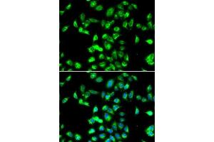 Immunofluorescence analysis of MCF7 cells using Kallistatin (SERPIN) antibody (ABIN6131346, ABIN6147573, ABIN6147574 and ABIN6223161). (SERPINA4 anticorps  (AA 178-427))