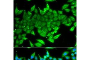 Immunofluorescence analysis of A549 cells using TTF2 Polyclonal Antibody (TTF2 anticorps)