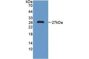 Western blot analysis of recombinant Human NXN. (NXN anticorps  (AA 166-327))