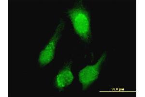 Immunofluorescence of purified MaxPab antibody to TCL1A on HeLa cell.