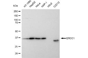 Western blotting analysis using ERCC1 antibody (ABIN7798539). (Recombinant ERCC1 anticorps)