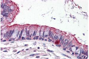 Human Lung (formalin-fixed, paraffin-embedded) stained with ELOVL6 antibody ABIN343916 at 5 ug/ml followed by biotinylated goat anti-rabbit IgG secondary antibody ABIN481713, alkaline phosphatase-streptavidin and chromogen. (ELOVL6 anticorps  (N-Term))