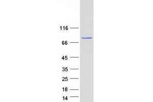 Validation with Western Blot