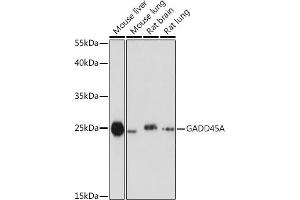 Western blot analysis of extracts of various cell lines, using GA antibody (ABIN6130412, ABIN6140923, ABIN6140926 and ABIN6215461) at 1:1000 dilution. (GADD45A anticorps  (AA 1-165))