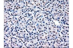 Immunohistochemical staining of paraffin-embedded Ovary tissue using anti-MRI1mouse monoclonal antibody. (MRI1 anticorps)