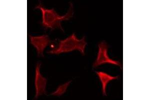 ABIN6275678 staining 293 by IF/ICC. (CACNA2D4 anticorps  (Internal Region))