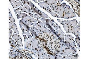 IHC analysis of Transketolase/TKT using anti-Transketolase/TKT antibody (ABIN7598958). (TKT anticorps  (AA 1-116))