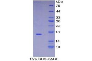 SDS-PAGE (SDS) image for Pre-B Lymphocyte 1 (VPREB1) (AA 43-134) protein (His tag) (ABIN1878975)