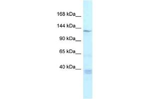 WB Suggested Anti-Tnks Antibody Titration: 1. (TNKS anticorps  (Middle Region))