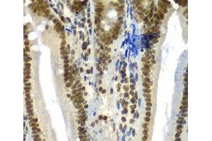 Immunohistochemistry of paraffin-embedded Mouse Intestine using SF3B2 Polyclonal Antibody at dilution of 1:100 (40x lens).