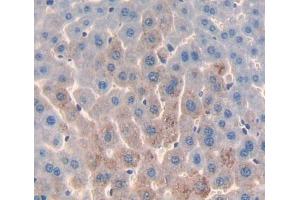 Used in DAB staining on fromalin fixed paraffin- embedded liver tissue