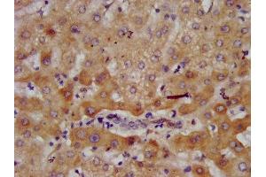IHC image of ABIN7143624 diluted at 1:700 and staining in paraffin-embedded human liver tissue performed on a Leica BondTM system.