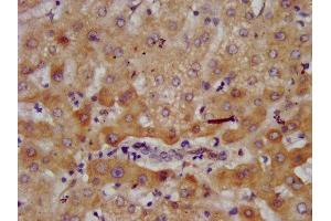 IHC image of ABIN7143624 diluted at 1:700 and staining in paraffin-embedded human liver tissue performed on a Leica BondTM system. (AGXT2 anticorps  (AA 196-328))