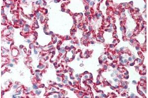 Rat Lung (formalin-fixed, paraffin-embedded) stained with CLDN5 antibody ABIN337059 at 5-10 ug/ml followed by biotinylated anti-mouse IgG secondary antibody ABIN481714, alkaline phosphatase-streptavidin and chromogen.