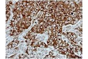 Immunohistochemistry: PPP3CB antibody staining of Paraffin-Embedded H661 Xenograft at 1/500 dilution. (PPP3CB anticorps)