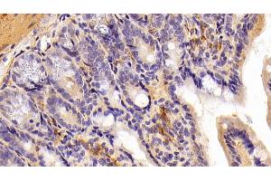 Detection of ADIPOR2 in Mouse Colon Tissue using Polyclonal Antibody to Adiponectin Receptor 2 (ADIPOR2)