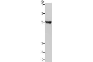 Gel: 6 % SDS-PAGE, Lysate: 40 μg, Lane: Human fetal brain tissue, Primary antibody: ABIN7191717(NRG3 Antibody) at dilution 1/200, Secondary antibody: Goat anti rabbit IgG at 1/8000 dilution, Exposure time: 2 minutes (Neuregulin 3 anticorps)