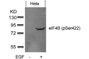 Western blot analysis of extracts from Hela cells untreated or treated with EGF using eIF4B(phospho-Ser422) Antibody. (EIF4B anticorps  (pSer422))