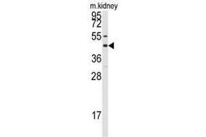 Image no. 1 for anti-Gap Junction Protein, alpha 8, 50kDa (GJA8) (C-Term) antibody (ABIN357099)