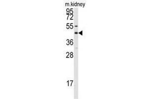 Image no. 1 for anti-Gap Junction Protein, alpha 8, 50kDa (GJA8) (C-Term) antibody (ABIN357099) (GJA8 anticorps  (C-Term))