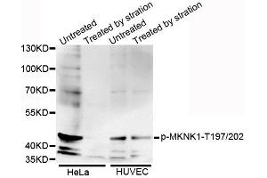 Western blot analysis of extracts of various cell lines, using Phospho-MKNK1-T197/202 antibody.