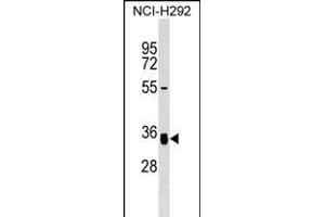 GNPTG Antibody (C-term) (ABIN1536973 and ABIN2849730) western blot analysis in NCI- cell line lysates (35 μg/lane). (GNPTG anticorps  (C-Term))