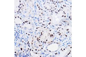 Immunohistochemistry of paraffin-embedded human colon using SOX9 Rabbit pAb (ABIN1682861, ABIN5664083, ABIN5664085 and ABIN6219552) at dilution of 1:100 (40x lens).