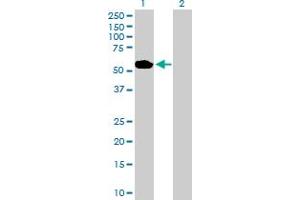 Western Blot analysis of ABLIM1 expression in transfected 293T cell line by ABLIM1 MaxPab polyclonal antibody. (ABLIM1 anticorps  (AA 1-401))