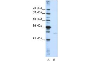 WB Suggested Anti-EMG1 Antibody Titration:  0. (EMG1 anticorps  (N-Term))