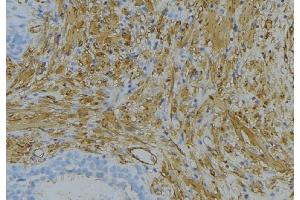 ABIN6274624 at 1/100 staining Human uterus tissue by IHC-P.
