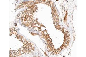 ABIN6267704 at 1/200 staining human testis tissue sections by IHC-P. (IKBKG anticorps  (pSer31))