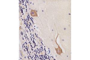 (ABIN6244287 and ABIN6577245) staining CK2 in human cerebellum tissue sections by Immunohistochemistry (IHC-P - paraformaldehyde-fixed, paraffin-embedded sections).