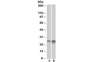 Western blot testing of human kidney [A] and liver [B] lysate with APOD antibody at 0. (Apolipoprotein D anticorps)