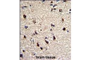 Formalin-fixed and paraffin-embedded human brain with DPT Antibody (Center), which was peroxidase-conjugated to the secondary antibody, followed by DAB staining.