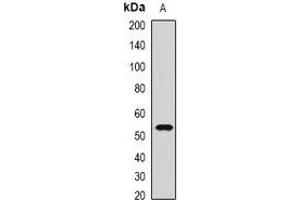 Western blot analysis of CMG2 expression in PC3 (A) whole cell lysates. (ANTXR2 anticorps)