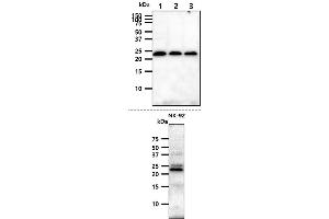 The cell lysates (40ug) were resolved by SDS-PAGE, transferred to PVDF membrane and probed with anti-human KLRD1 antibody (1:1000).