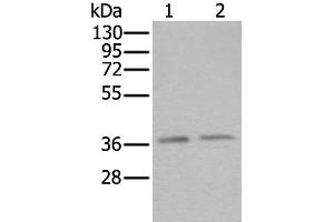 Western blot analysis of Hela and Raji cell lysates using ATXN7L3 Polyclonal Antibody at dilution of 1:500