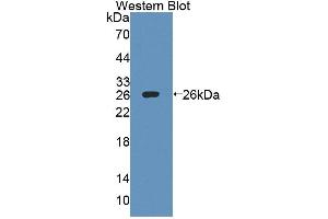 Western blot analysis of the recombinant protein. (IL27 Receptor alpha anticorps  (AA 93-273))